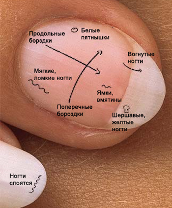 Ногти и здоровье 25425308_nail