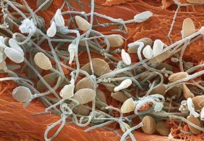 организм человека под микроскопом фото 9 (700x485, 213Kb)