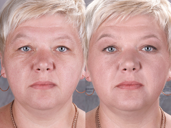 С кремом Stem Cell Therapy – красота лица не боится возраста (3) (700x525, 513Kb)