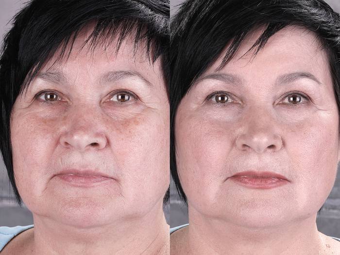 С кремом Stem Cell Therapy – красота лица не боится возраста (5) (700x525, 479Kb)
