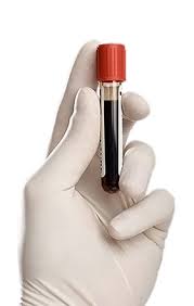 Учимся понимать свои анализы крови 116099179_5283370_krov