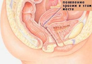 петербург-диетпродукт