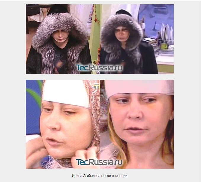 Ирина до и после