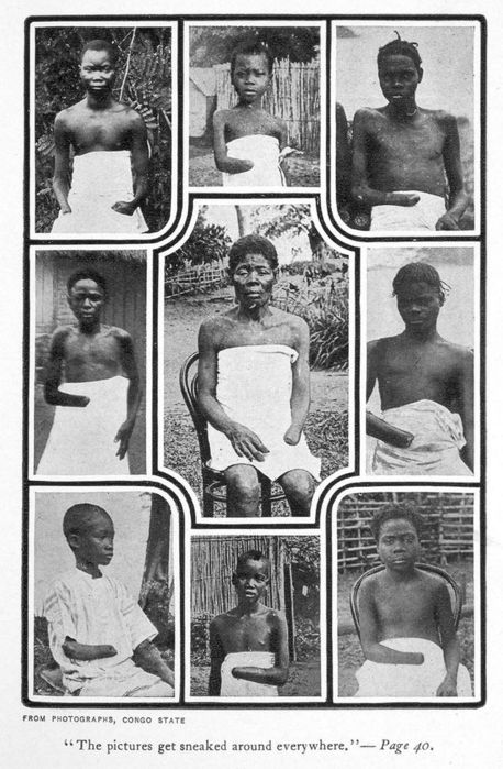 640px-MutilatedChildrenFromCongo (458x700, 77Kb)