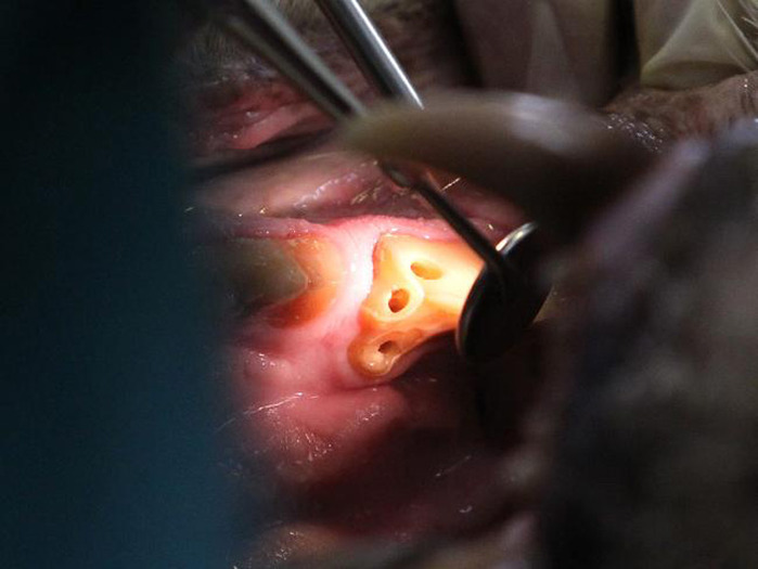 053102-tiger-root-canal (700x525, 65Kb)