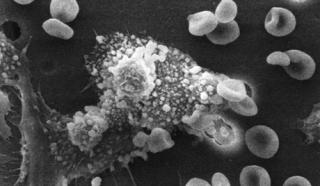 4Macs_killing_cancer_cell (320x186, 11Kb)