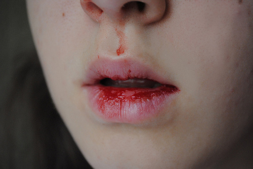 81561245_2348258_tumblr_l9px8zBTJK1qaj6i0o1_500 (500x334, 60Kb)