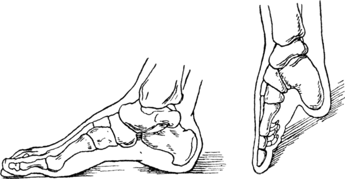 800px-ChineseLadieFoot (700x363, 43Kb)