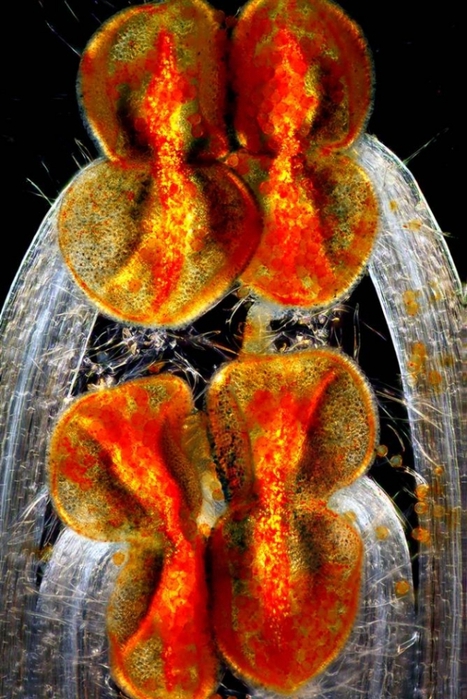 макрофото Olympus BioScapes Imaging Competition 2012 7 (467x700, 291Kb)