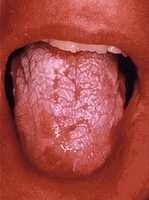 candida_ (149x200, 62Kb)
