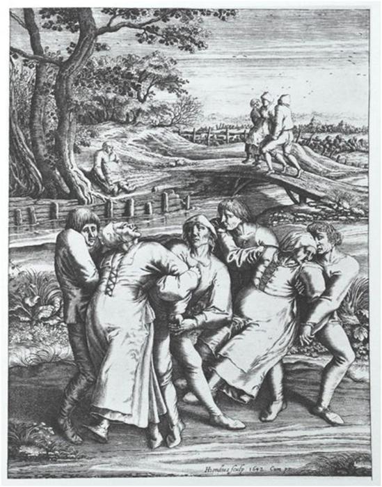 Безумная пляска святого Вита — танцевальная лихорадка-хореомания в Средневековье