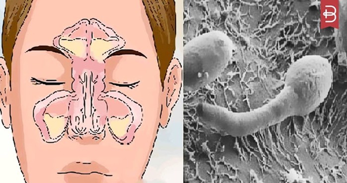 Проблема заложенности вашего носа находится в вашем кишечнике