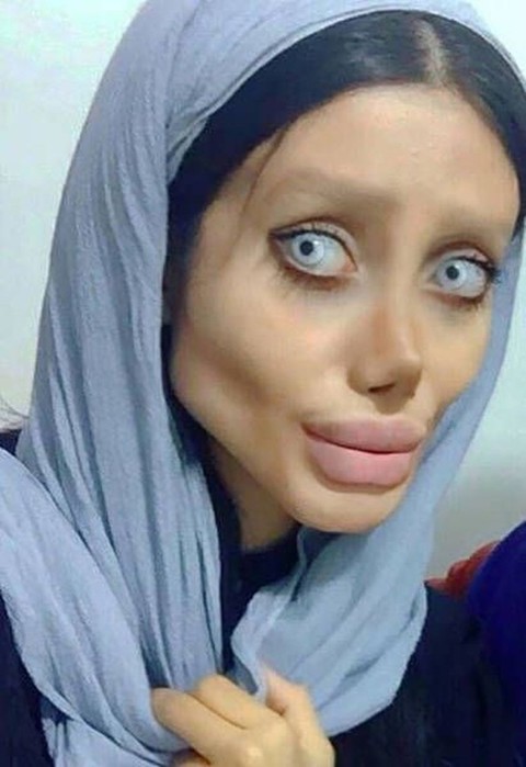 22 летняя иранка сделала 50 пластических операций, чтобы стать двойником Анджелины Джоли