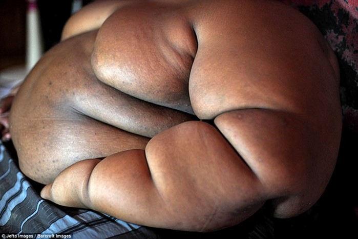 Самый толстый мальчик в мире решился на похудение и сбросил 83 килограмма
