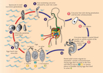 Превью issue11schistosomiasis6_l (520x369, 121Kb)