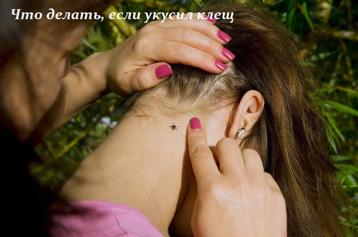 2749438_Chto_delat_esli_ykysil_klesh (700x464, 482Kb)