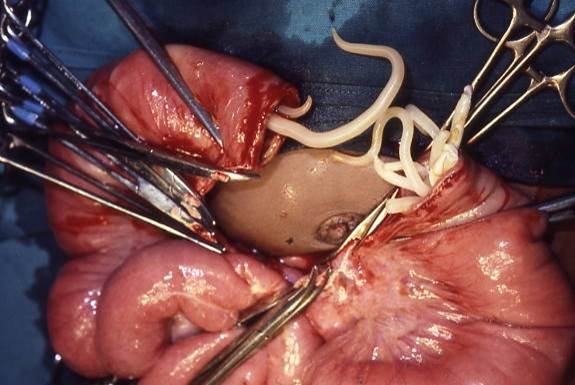 Ascaris_infection-_Difficult_intestinal_anastamosis_-_joining_up_of_two_ends-_clearly_if_we_cut_out_a_section_of_bowel_we're_left_with_two_ends_that_need_to_be_joined_up_(South_Africa)_(15806559973) (575x385, 188Kb)