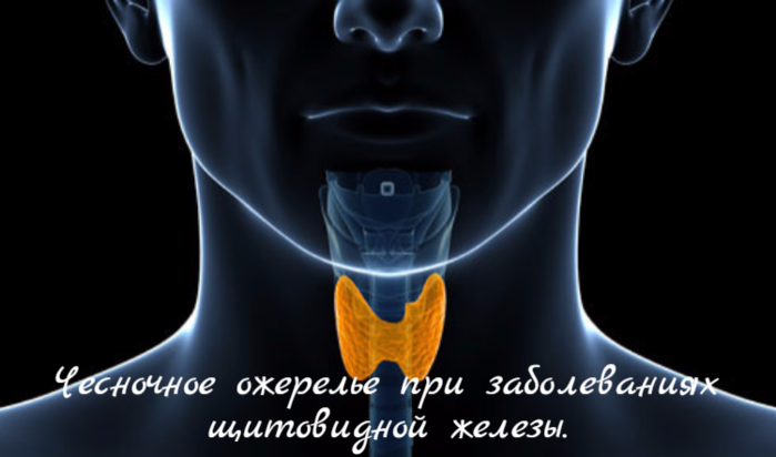 alt="Чесночное ожерелье при заболеваниях щитовидной железы."/2835299__3_ (700x412, 215Kb)