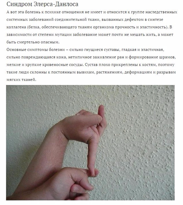 3 (624x700, 378Kb)