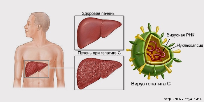 3925073_14716035vidyigepatitaiegopriznaki (700x350, 99Kb)