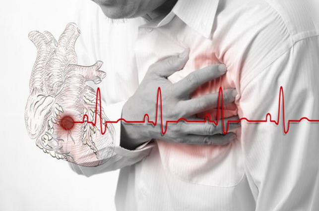 В чем разница между инсультом, инфарктом и остановкой сердца?