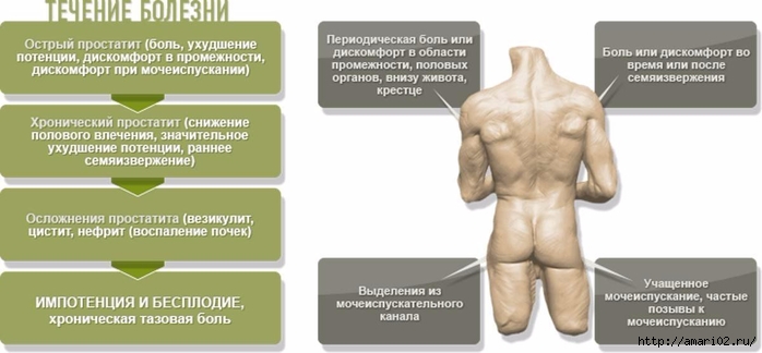 21519210-prostatit-i-kreatinin (700x324, 121Kb)