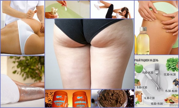 2749438_Sposobi_ystraneniya_cellulita (700x420, 78Kb)