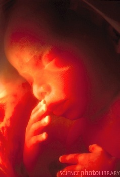 P680474-Foetus-SPL (237x350, 20Kb)