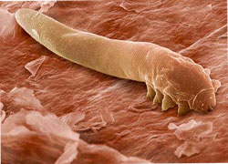 demodex_lechenie (250x180, 17Kb)