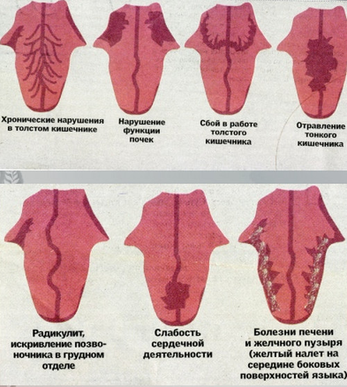 Заболевания языка фото и описания