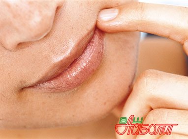 Как быстро убрать простуду на губах?