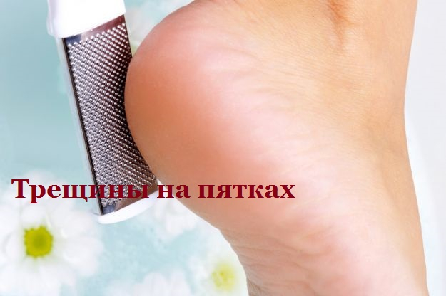 00а (625x416, 151Kb)