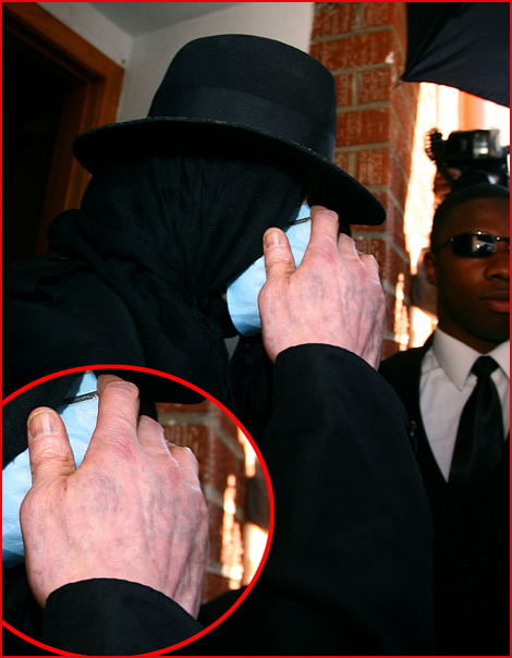 Джексона обвинили. Руки Майкла Джексона 1990е.