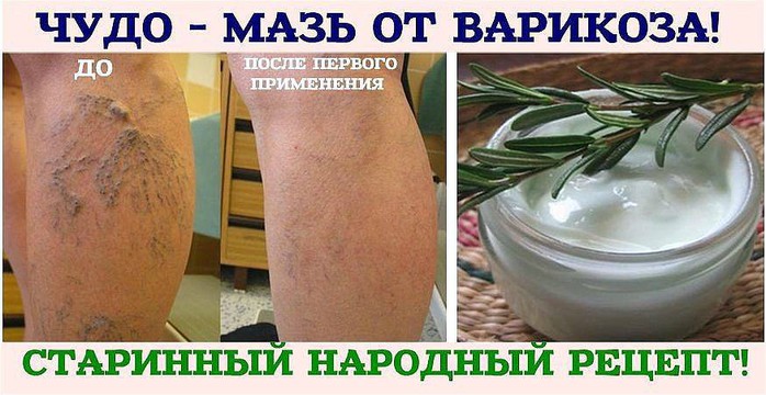 image (700x360, 85Kb)