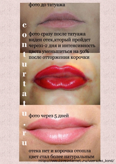 Как проявляется перманентный макияж губ по дням фото