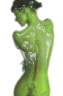 radikulit1 (213x320, 54Kb)