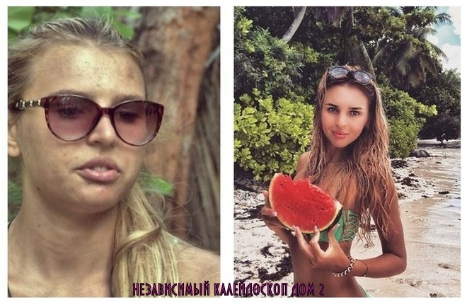 Элла суханова фото до и после пластики
