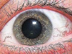eye (240x180, 34Kb)