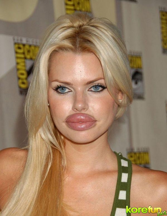 annoying-girls-with-huge-lips12 (540x700, 229Kb)