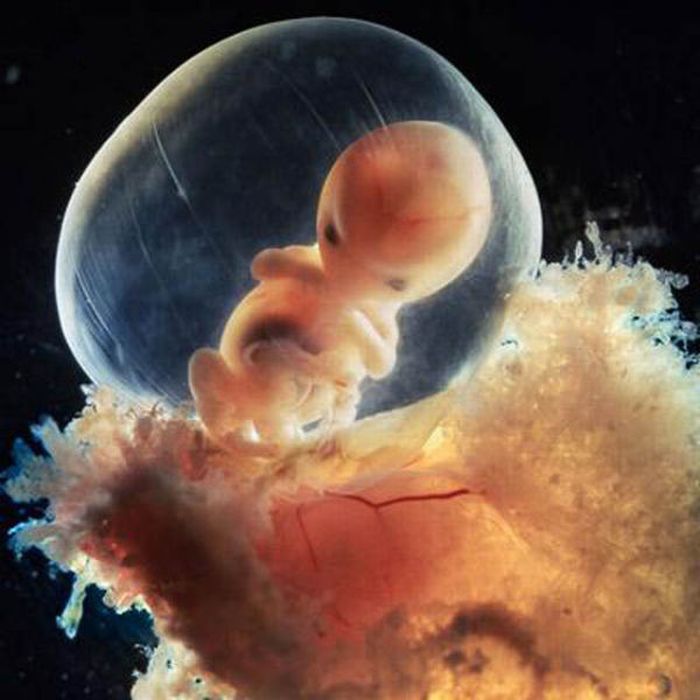    /2045074_incredible_photos_a_child_is_born_16 (700x700, 63Kb)
