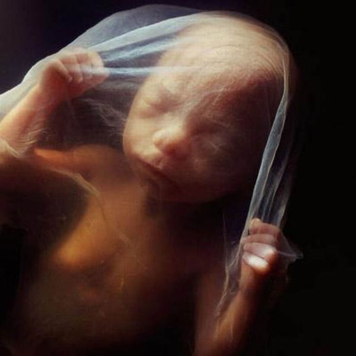    /2045074_incredible_photos_a_child_is_born_20 (700x700, 43Kb)