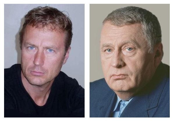 Олег штефанко фото до и после пластики