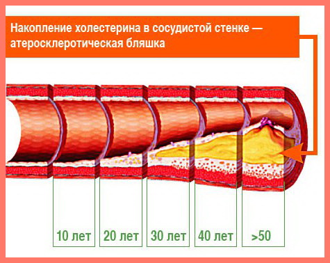 fig4 (475x378, 71Kb)