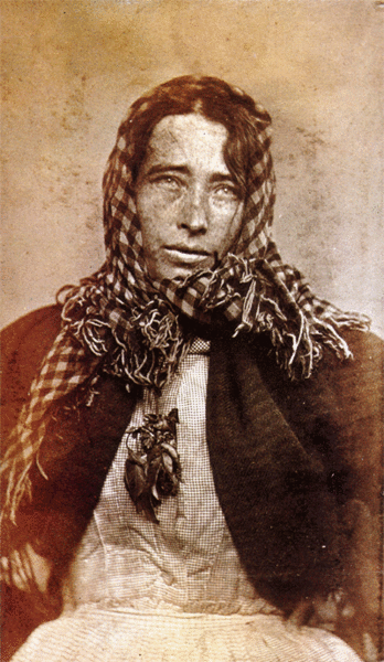 Photographer unknown Psychiatric Patient Diagnosed With Melancholy 1876 (348x600, 181Kb)