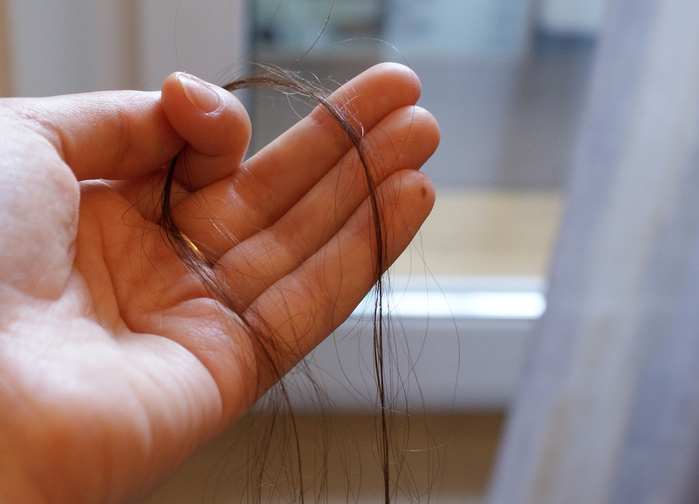 Почему выпадают волосы при мытье головы