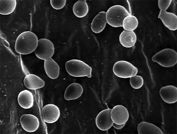 More_yeast (600x453, 142Kb)