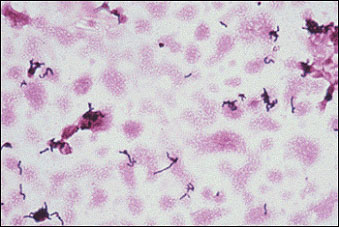 Propionibacterium_acnes (339x227, 31Kb)