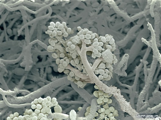 mold (528x393, 74Kb)