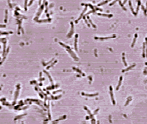 desulfitobacterium (214x180, 13Kb)