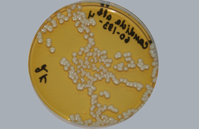 fungi0 (700x455, 70Kb)